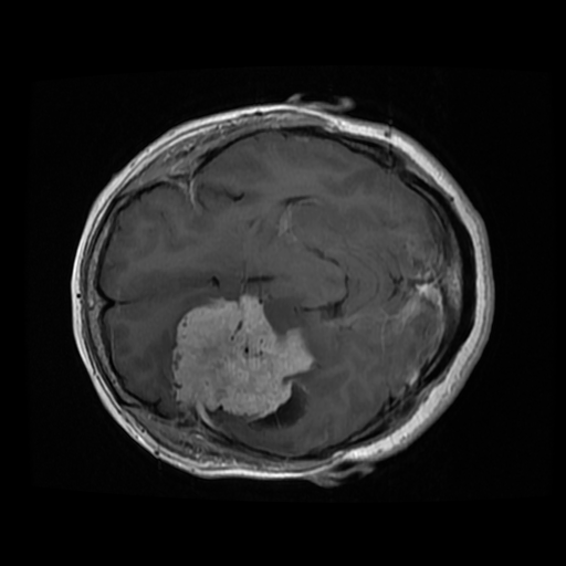 Example MRI scan