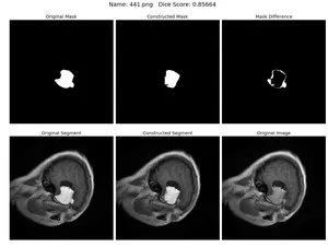 Result, Dice score 0.85664
