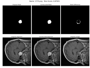 Result, Dice score 0.87921